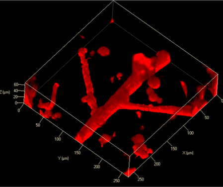 UpNano_News_Blood_vessels