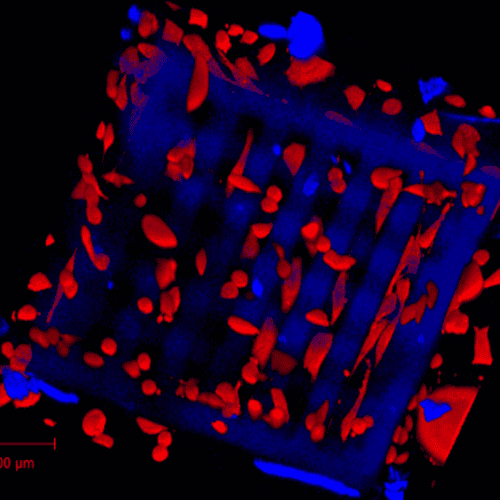 UpNano_News_Osteoblasts